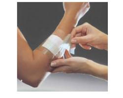 FILM ADESIVO IN POLIURETANO OPSITE FLEXIFIX IN ROTOLO TRASPARENTE IMPERMEABILE PER FISSAGGIO DI MEDICAZIONI E CATETERI LARGHEZZA 15 CM LUNGHEZZA 10 M 1 PEZZO - famajoy.it